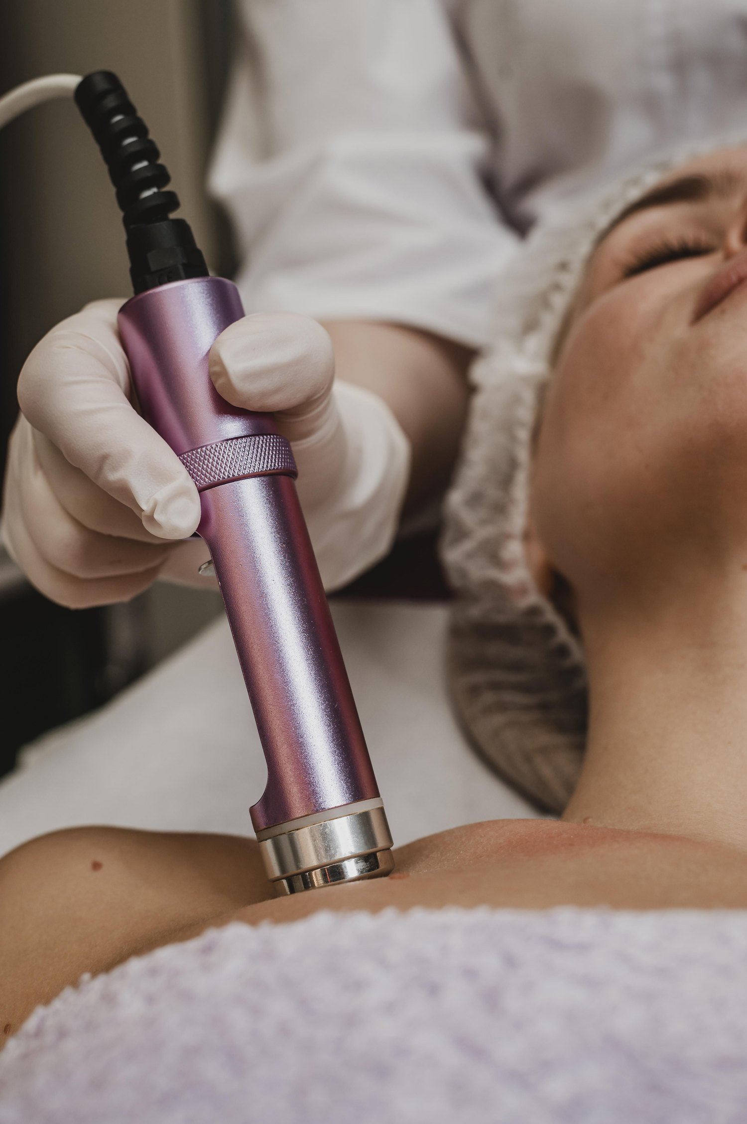 Aplicação do Laser Etherea no colo de uma paciente na OligoVitta em Limeira